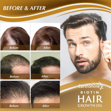 Load image into Gallery viewer, Biotin Hair Re Growth Oil For Men and Women