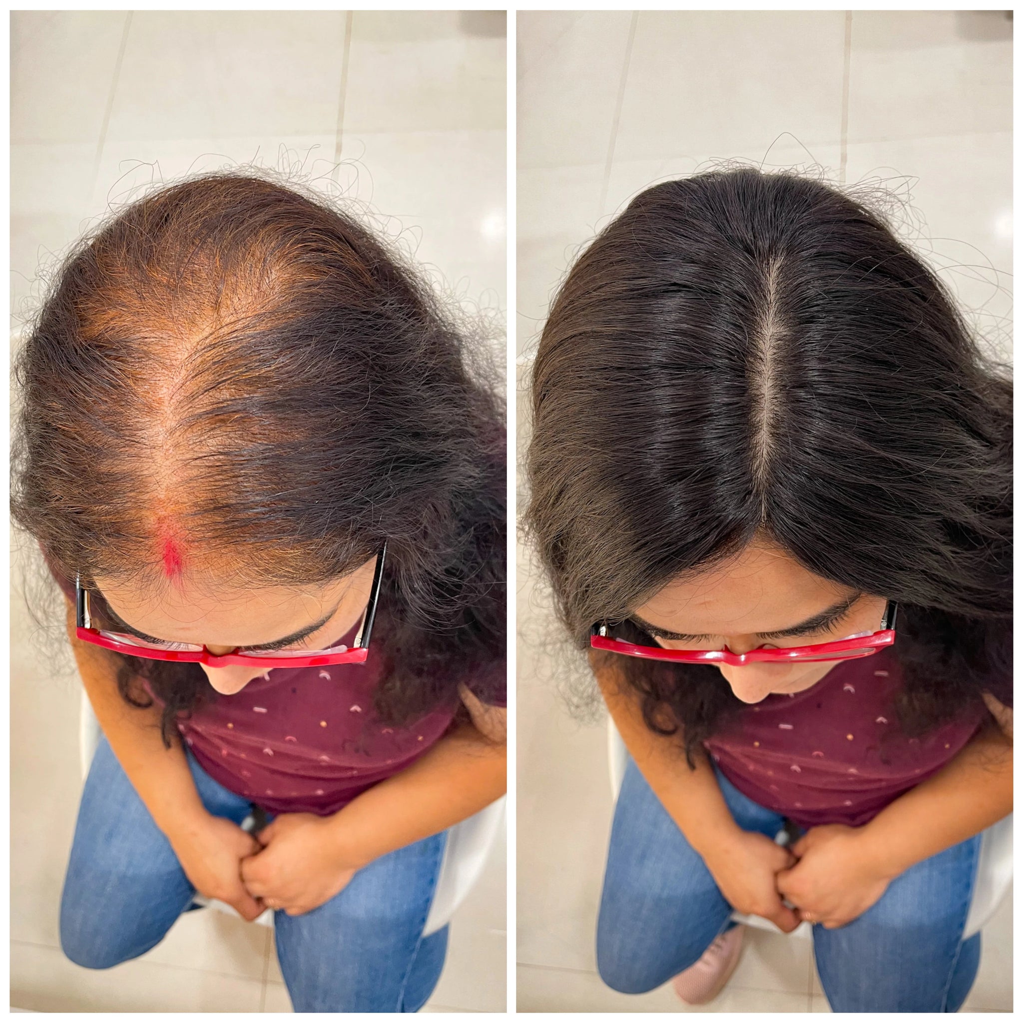 InstaHair LightTop Light Volume Hair Topper – TopHair Topper