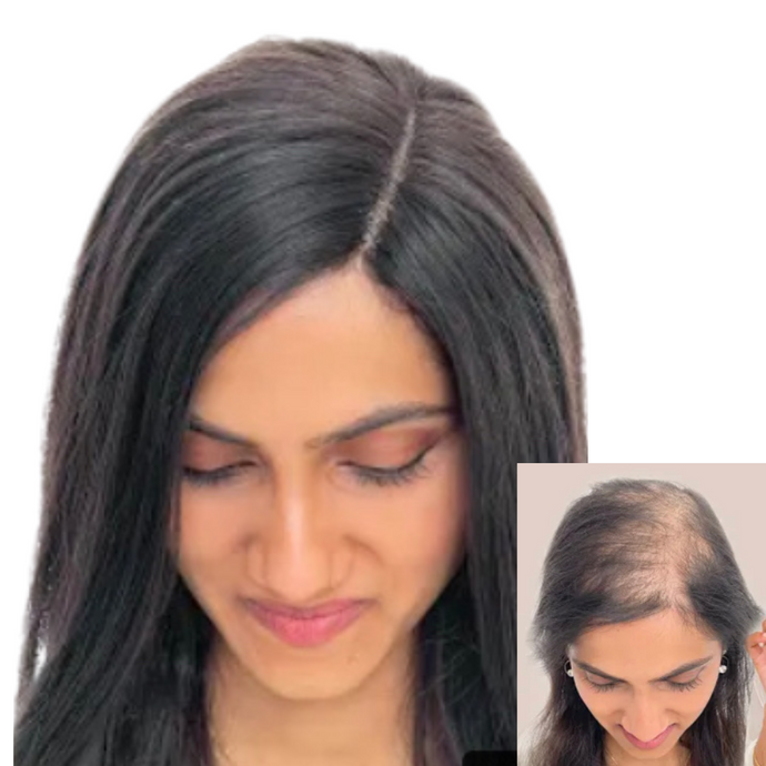 LavishTop Natural Scalp hair topper for women with thinning hair