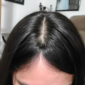 LavishTop Natural Scalp Hair Topper